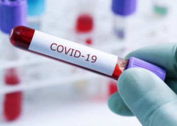 Covid-19 : La RDC a dépassé la barre 29.000 personnes guéries et atteint 1.018 décès