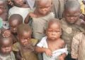 Kamanyola : recrudescence des cas de kwashiorkor chez les enfants.